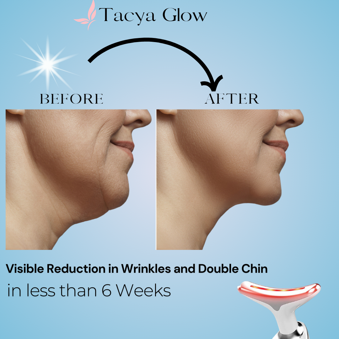 Tacya Glow LED Face Lift